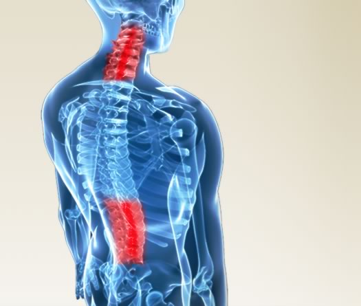 Tips about How to Treat Degenerative Disc Disease