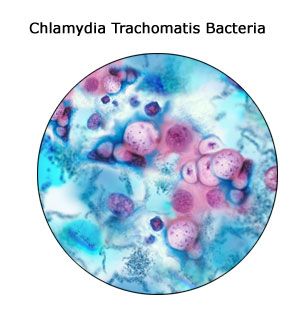 how to prevent chlamydia trachomatis