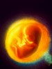 Difference Between Embryo and Fetus