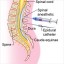 Epidural and Spinal