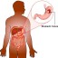 learn about the Stages of Stomach Cancer