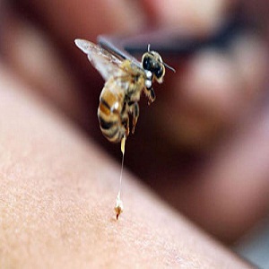 How to Treat a Wasp or Hornet Sting