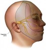 Trigeminal neuralgia