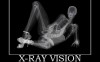 x-ray