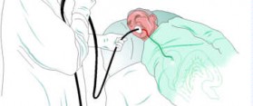 Esophagogastroduodenoscopy