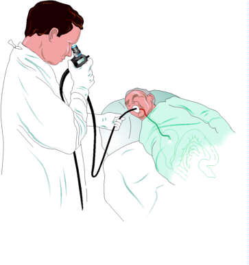 Esophagogastroduodenoscopy