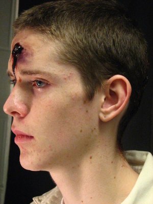 Fake Gunshot Wound
