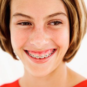 Girl Smiling with Braces