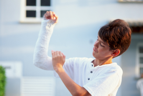 Broken Arm. 