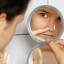 How to Remove Blackheads from Nose Fast at Home
